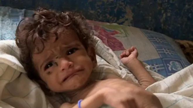 यमन में चल रहे गृहयुद्ध ने लाखों को धकेला भुखमरी के चगुंल में, कई इलाकों में नहीं पहुंच पा रही हैं अंतरराष्ट्रीय सहायता एजेंसियां.बीबीसी की विशेष रिपोर्ट.