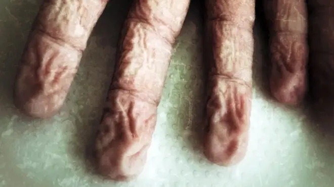 گیلی انگلیوں پر نمودار ہونے والی جھریاں