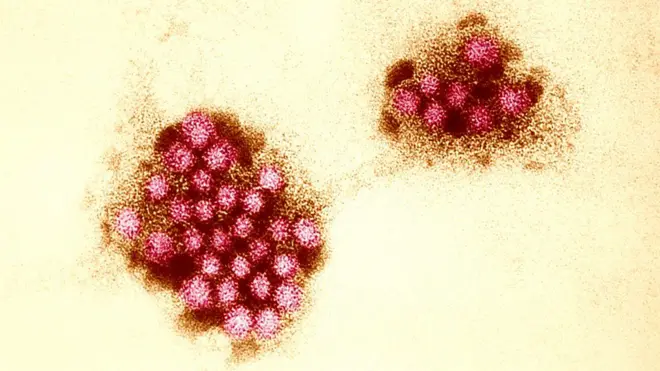 Imagema roleta decidevírusa roleta decidemicroscopio