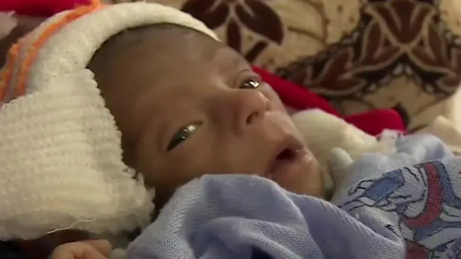 عرب ممالک میں سب سے زیادہ غریب ملکوں سے ایک یمن می