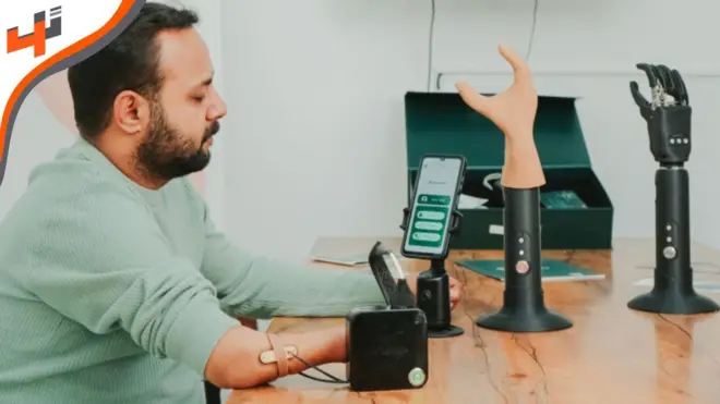 أطراف اصطناعية ذكية باستخدام التكنولوجيا المتقدمة