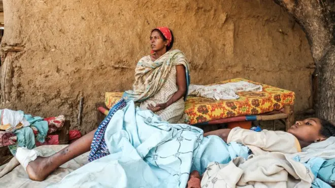 ኣብ ሑመራ ብ22 ሕዳር 2020 ብዝነበረ ደብዳብ ከበድቲ ብረት ምስ ኣዲኣ ቆሲላ ሕክምና ዝረኸበት ጓል ኣንስተይቲ