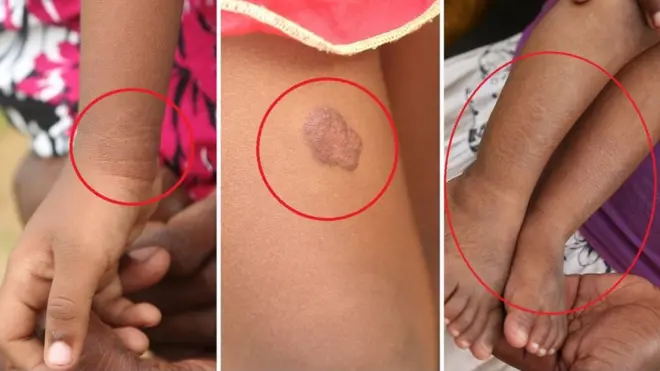 "දොස්තරලා දන්නෙත් නැහැ ලෙඩේ මොකද්ද කියල. බලාගාරේ ළඟ ඉන්නේ කිව්වම කියනවා මෙතැනින් අයින් වෙන්නලු. ළමයව බිම තියන්න එපාලු"