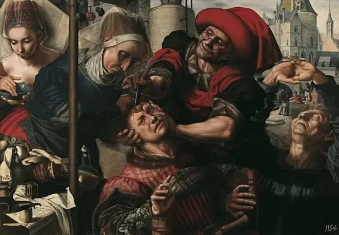 Chirurgie, 1550-1555. Artiste : Jan Sanders van Hemessen.