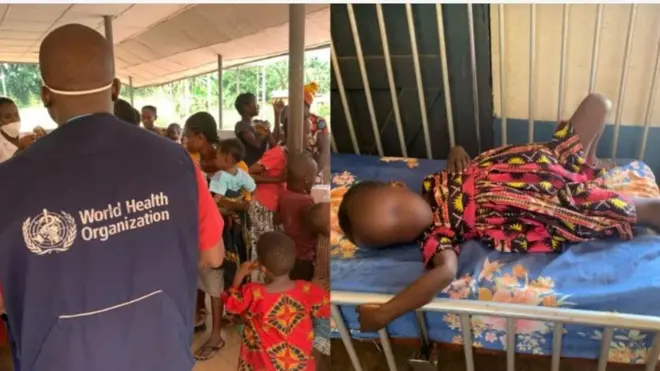 Awọn ọmọde to wa nile iwosan