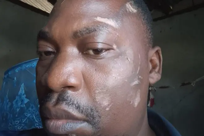 .