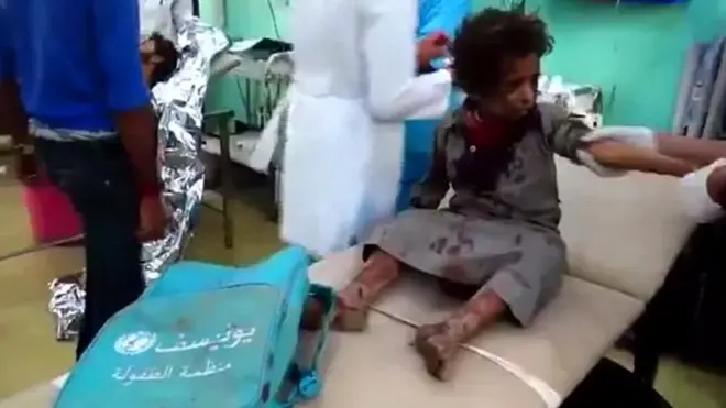 यमन, हूथी विद्रोही,