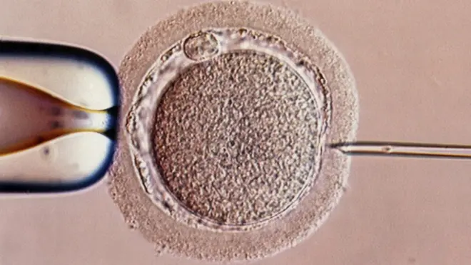 The baby was conceived using an experimental form of IVF