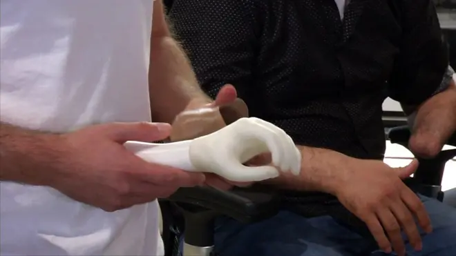 إنتاج أطراف صناعية عبر طابعات ثلاثية الأبعاد في الأردن