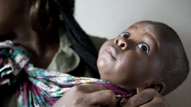 Afriikaa Bahaa fi Kibbaa keesssatti daa'imman kuma 48tu guyyaatti dhalatu