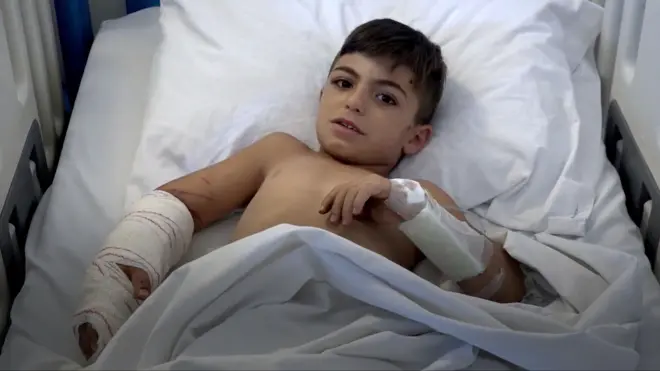 레바논 공습으로 부상당한 어린이