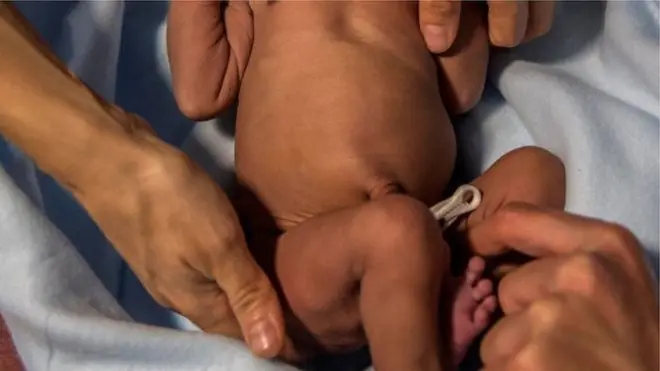 UNICEF ni awọn ọmọ tuntun ti a maa bi ni Naijiria a tó ìdá meje ninu ọgọrun un gbogbo ikoko ti a maa bi lagbaye