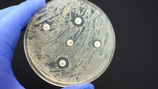 Las bacterias resistentes a medicamentos antimicrobianos es una amenaza para la salud a nivel mundial.