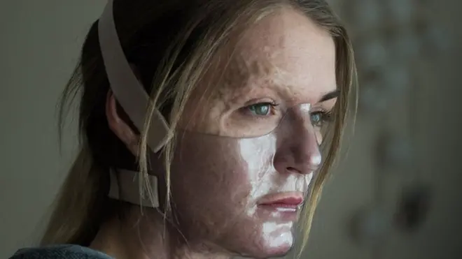 Vicky Knight posing in the film, wearing a clear face mask for her character's facial surgery