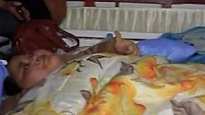 "أثقل امرأة في العالم" تغادر مصر للعلاج في الهند