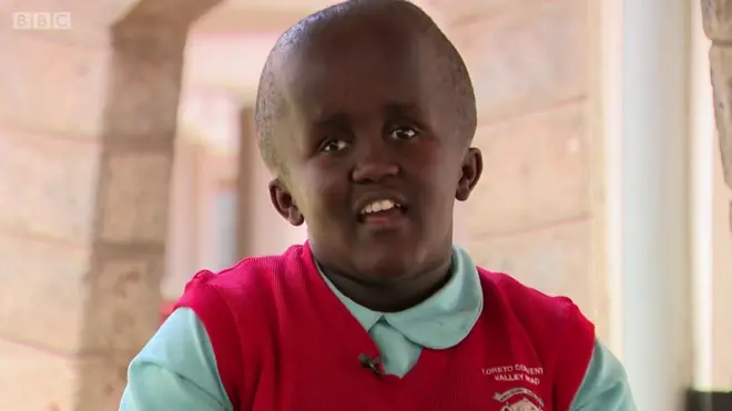 선천성수두증: 케냐에 사는 14살 엔젤 이야기