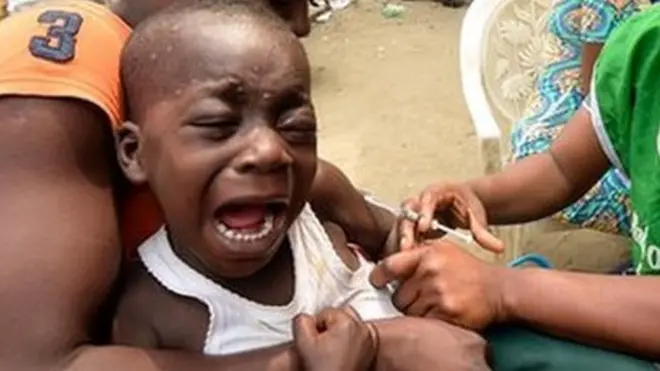 Daa'imman miiliyoona 20 ta'an akka adduunyaatti talaallii dhukkuba gifiraa hin argatani