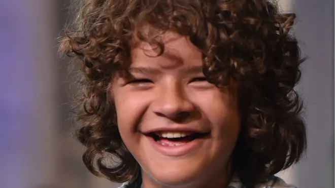 El personaje que interpreta Gaten Matarazzo en Stranger Things, Dustin Henderson, también tiene displasia cleidocraneal.