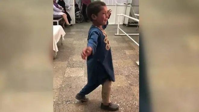 طفل أفغاني يرقص بساق اصطناعية