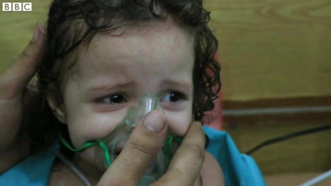 「世界はシリアに背を向けた」　2歳児も呼吸困難に