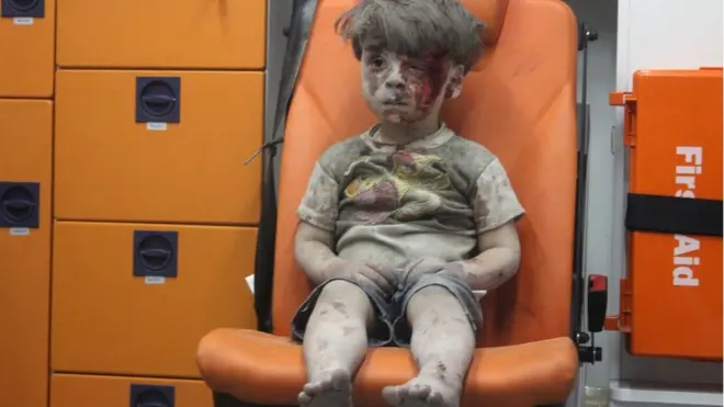 Hình ảnh em bé Syria bê bết bụi, máu và vẻ mặt thẫn thờ được cứu từ tòa nhà bị không tạc ở Aleppo đã gây chấn động thế giới. Em bé 5 tuổi Omran Daqneesh lúc đó ngồi trong xe cứu thương.