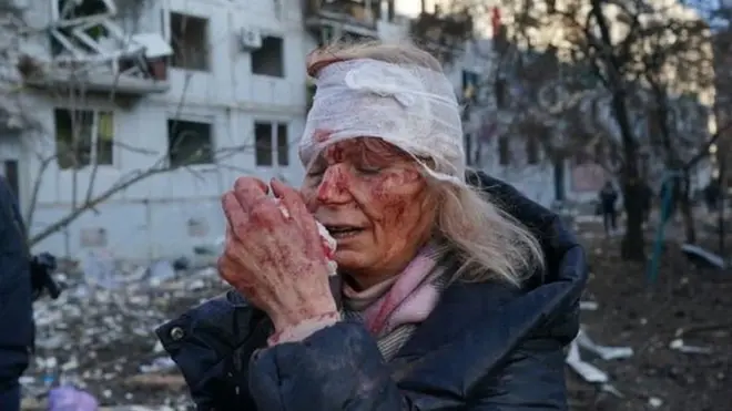 Una mujer herida a consecuencia de un ataque aéreo ruso en Járkov, en el este de Ucrania.