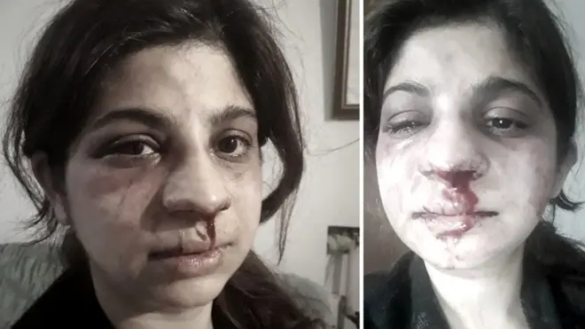 सोशल मीडिया