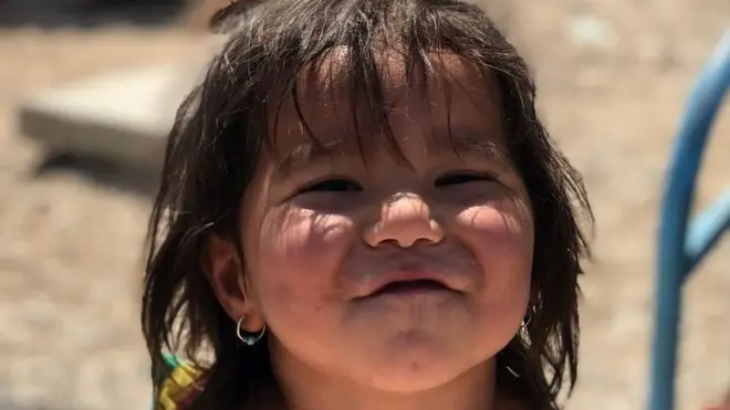 అల్ హాల్ క్యాంపులో వేలమంది చిన్నారులు తమ తల్లులతో కలిసి జీవిస్తున్నారు.