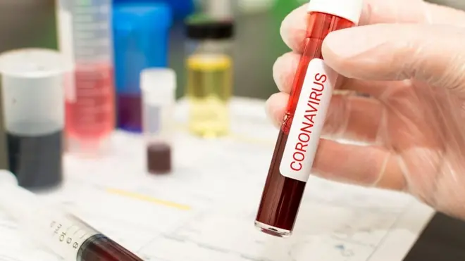 Ученые по всему миру бьются над созданием вакцины от коронавируса.