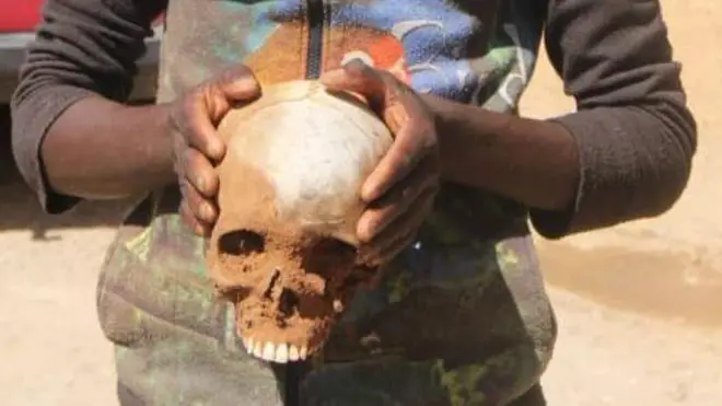 Àwòrán orí ènìyàn 