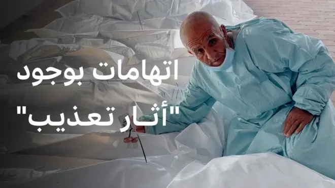 اتهامات بوجود "أثار تعذيب"