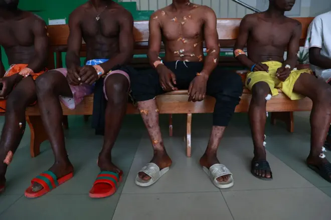 Image d'illustration. Des athlètes blessés à l'hôpital régional de Buea, au Cameroun, le 25 février 2023. - Trois explosions au départ d'un marathon ont blessé 18 personnes.