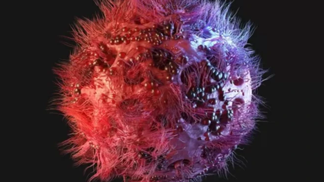 Mgonjwa aligunduliwa na VVU katika miaka ya 1980.