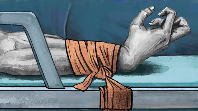 Рисунок: сведенная судорогой рука, привязанная полотняным бинтом к стальной раме кровати   