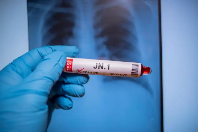 कोव्हिड 19