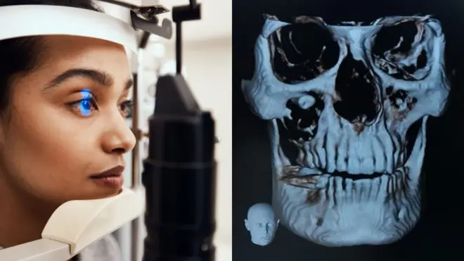 आधी धूसर दिसायला लागलं, मग थेट डोळ्यात दात आला