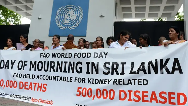 වකුගඩු රෝගීන් දහස් ගණනක් වාර්ෂිකව ශ්‍රී ලංකාවෙන් වාර්තා වන බව සෞඛ්‍ය දත්ත පෙන්වා දෙයි