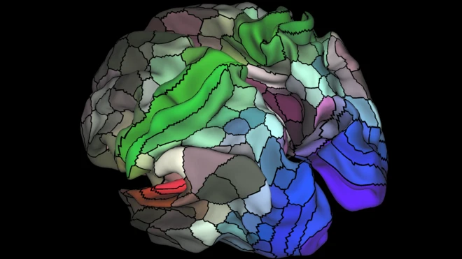 brain map