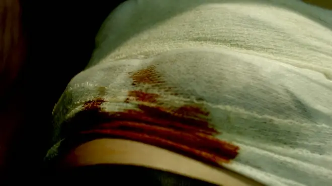 Після операції