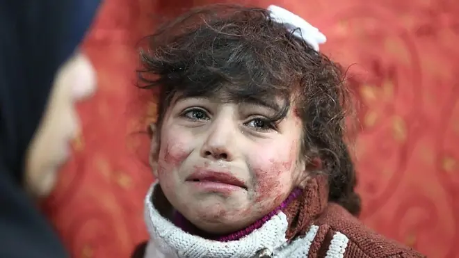 طفلة سورية من الفغزطة الشرقية