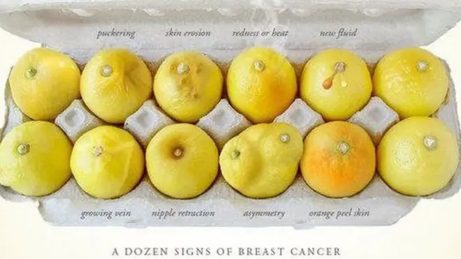Berbagai bentuk jeruk sebagai perbandingan bentuk payudara yang terkena kanker.