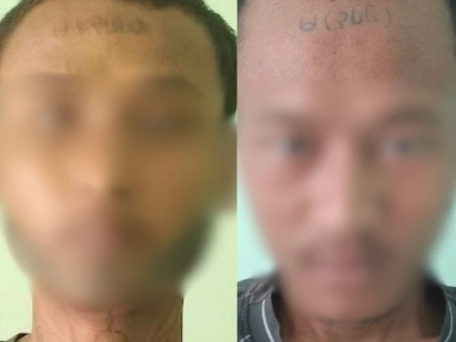 နဖူးမှာ တပ်ရင်းနံပတ်တွေ တက်တူးထိုးခံရတယ်လို့ လွတ်မြောက်လာသူ စစ်မှုထမ်းတွေပြောကြားချက်ကို အေအေက ထုတ်ပြန်ထားတာပါ။