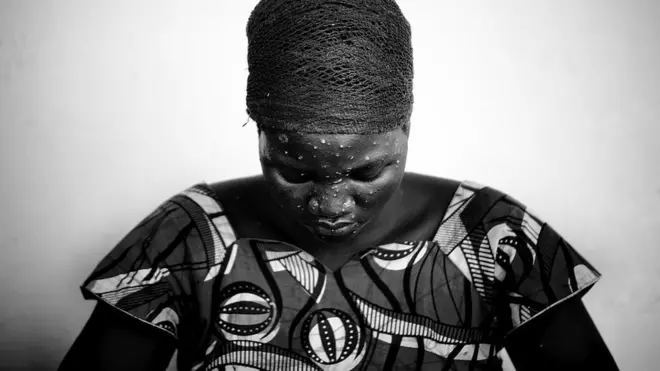 LODJA, DEMOCRATIC REPUBLIC OF CONGO