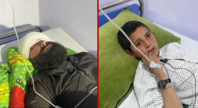  برمل کې د پاکستان بمبارۍ کې ټپیان شوي ولسي وګړي