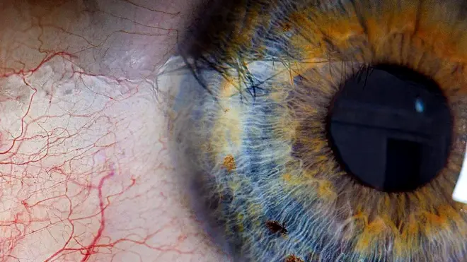 Человеческий глаз