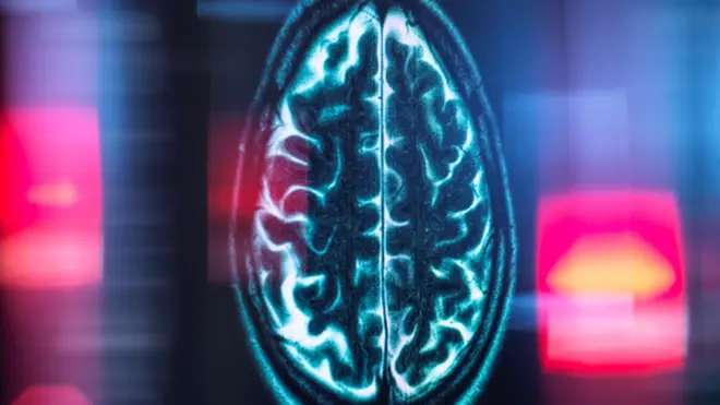 The image shows a digital scan of a human brain - seen from above. You can make our the outlines and folks of the cortex. 