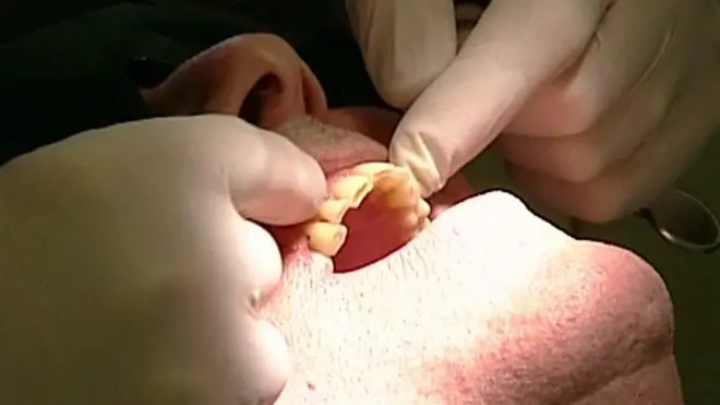 هل يمكن للأسنان أن تعالج نفسها ذاتيا؟