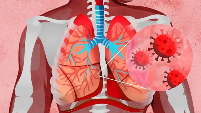 كيف يؤثر فيروس كورونا على الجسم؟