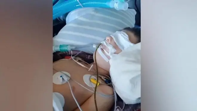 รถพยาบาลที่ฝ่าแนวรบเพื่อช่วยชีวิตเด็ก