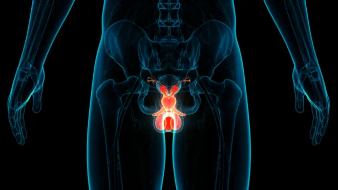 प्रोस्टेट कॅन्सर